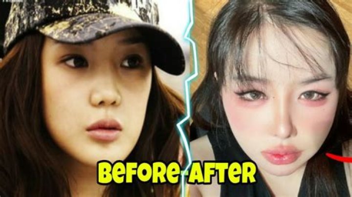 2ne1 Park Bom Before Surgery