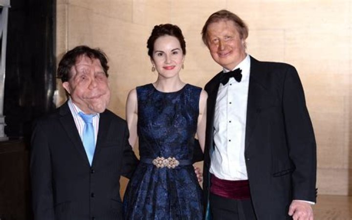 A Voice For Disability Advocacy And Representation