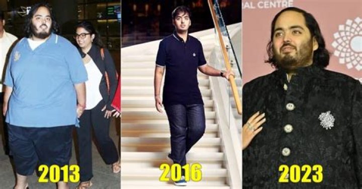 Anant Ambani's Transformative Journey: The Truth Behind His Fat Surgery