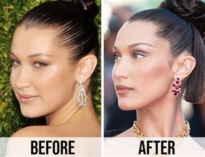 Bella Hadid Before After