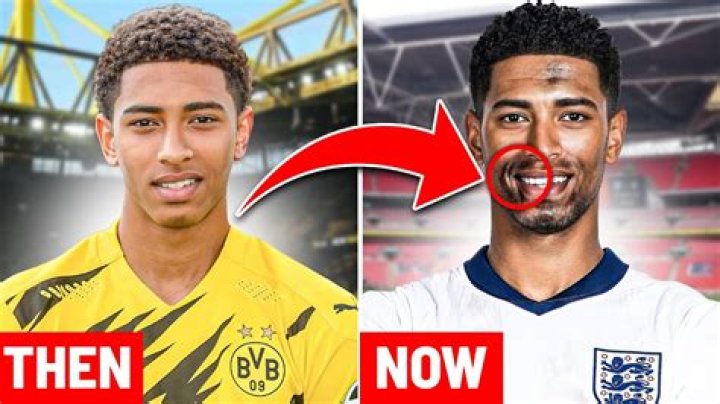 Bellingham: Uncovering The Beauty Of All Skin Colors