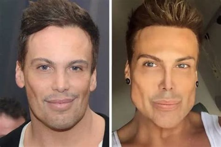 Unveiling The Truth Behind Botched Surgeries: Insights From Reddit