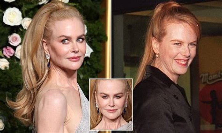 Unraveling The Truth: Does Nicole Kidman Have An Eating Disorder?