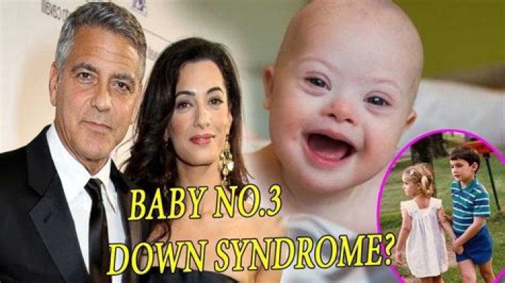 Unraveling The Truth Behind George Clooney's Son And Down Syndrome