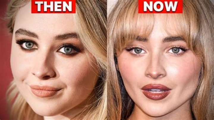 Unveiling The Truth: Has Sabrina Carpenter Got Plastic Surgery?