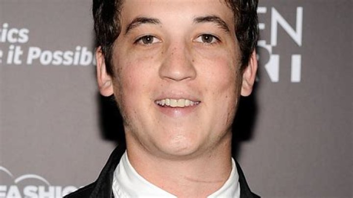 The Untold Story Behind Miles Teller's Scarred Appearance