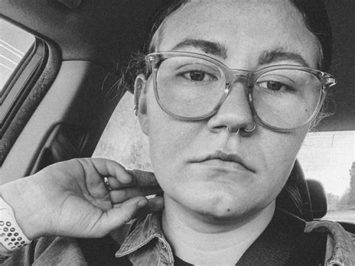 Get Expert Top Surgery From Leon Brown: Transformative Results, Enhanced Confidence