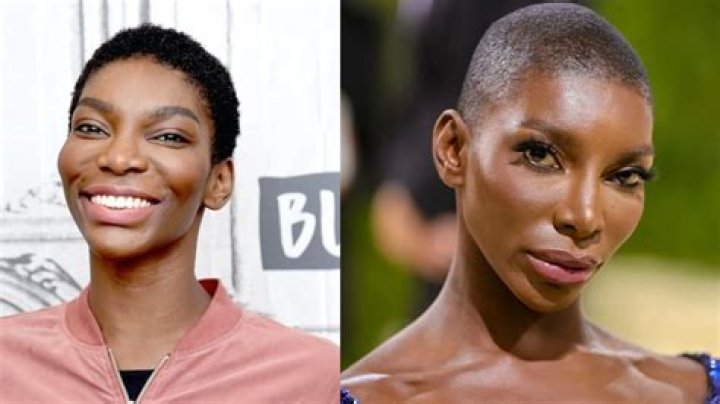 Unveiling The Truths Behind Michaela Coel's Plastic Surgery Journey