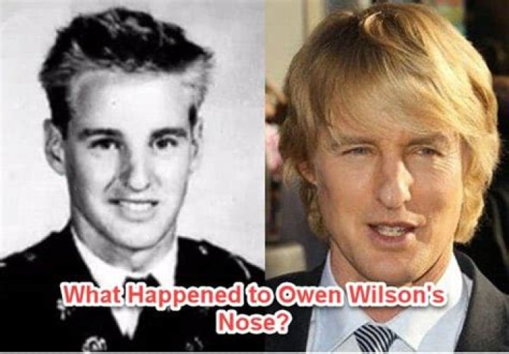 Unveiling Owen Wilson: The Charismatic Star Before His Broken Nose