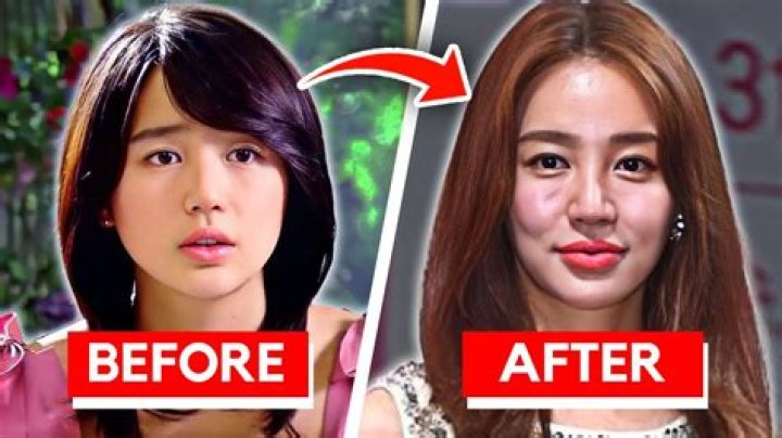 Korean Celebrity Plastic Surgery: Insights Into The Industry