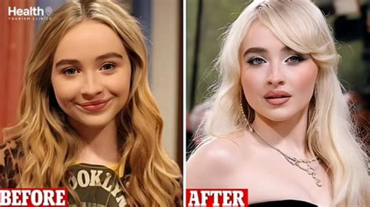 Sabrina Carpenter: A Journey Through Transformation Before Surgery