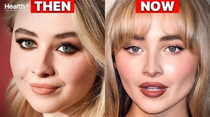 Sabrina Carpenter's Rhinoplasty: Unveiling The Truth Behind The Transformation