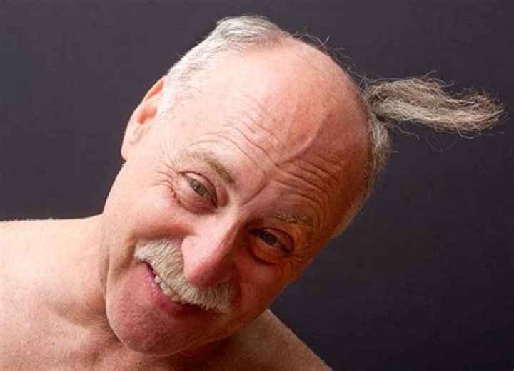 The Ultimate Guide To Embrace The Beauty Of Ugly Bald Men